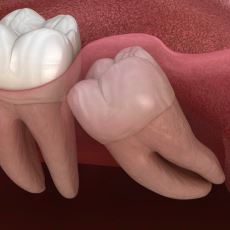 Atalarımız İçin Gerekli, Bizim İçin Artık İşlevsiz Olan Yirmilik Dişin Evrimi