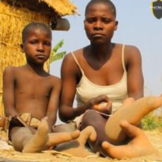 Deve Kuşuna Benzer Ayaklarıyla Zimbabve'de İzole Bir Hayat Süren Halk: Vadoma Kabilesi