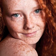 Kızıl Saçlı İnsanların Acı Eşiği Normale Oranla Daha Düşük 
