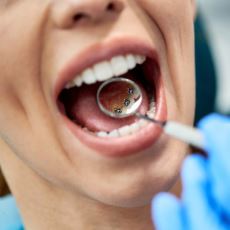 İçten Diş Telinin (Lingual Ortodonti) Avantaj ve Dezavantajları