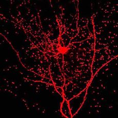 Yeni Keşfedilen Rosehip Nöronu, İnsanı Hayvanlardan Ayıran Temel Şey Olabilir mi?