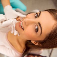Diş Teli Taktırmayı Düşünenler İçin: İşlem Aşamalarıyla Birlikte Ortodonti Tedavisi
