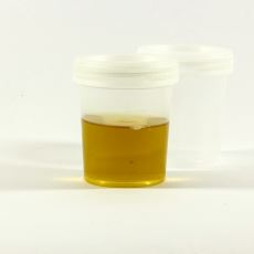 İdrar Neden Sarı Renklidir?