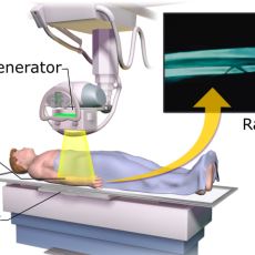Röntgen Cihazının Çalışma Prensibi