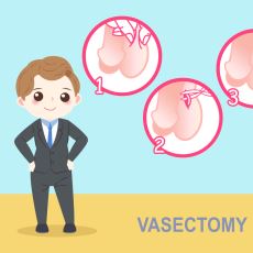 Erkek Sperm Yollarının Bağlandığı Doğum Kontrol Yöntemi: Vazektomi