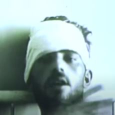 1955 Yılında İran'da Çekilen Rahatsız Edici Kuduz Videosu