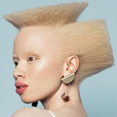 Vogue'a Kapak Olan İlk Albinizmli Kadın Model: Thando Hopa