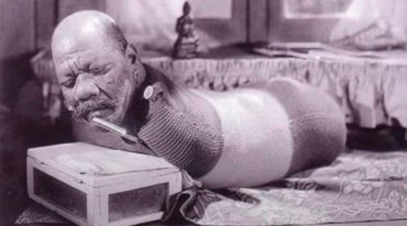 Doğuştan Kolsuz ve Bacaksız Olarak Nadir Bir Hastalıkla Doğan Adam: Prince Randian