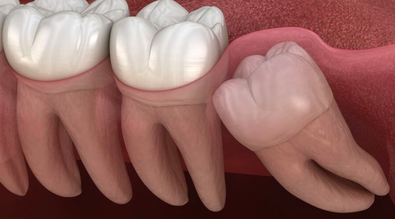 Atalarımız İçin Gerekli, Bizim İçin Artık İşlevsiz Olan Yirmilik Dişin Evrimi