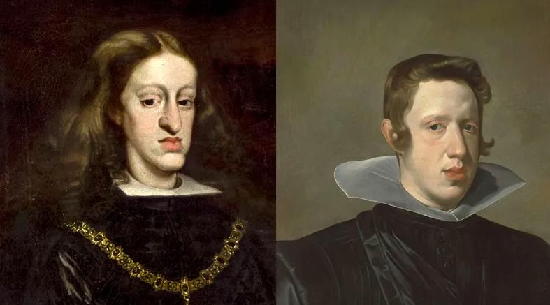 Bir Hanedanlığı Bitiren Genetik Miras: Habsburg Çenesi