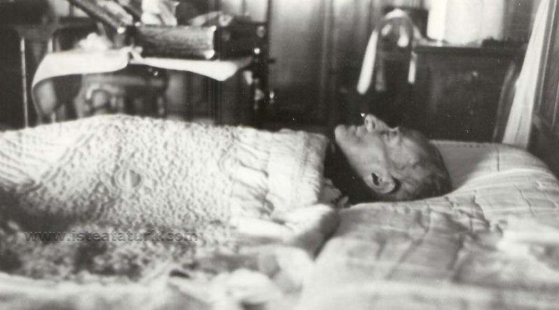 Atatürk'ü Öldüren Siroz Hastalığı, Günümüz Şartlarında Tedavi Edilebilir  miydi? - Ekşi Şeyler