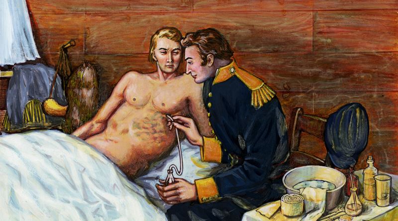 Ölmek Yerine Midesi Açık Bir Deneğe Dönüşen Alexis St. Martin'in İlginç Hikayesi