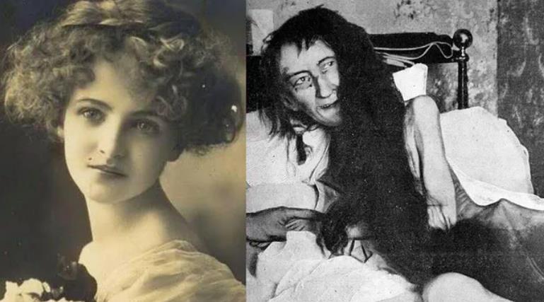 Ailesinin 25 Yıl Evin Gizli Bir Odasına Hapsettiği Zavallı Kadın: Blanche Monnier
